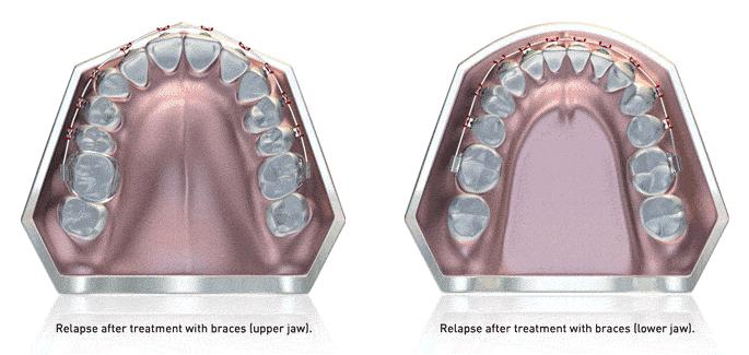 国民初恋毁容了,国民初恋盛世美颜