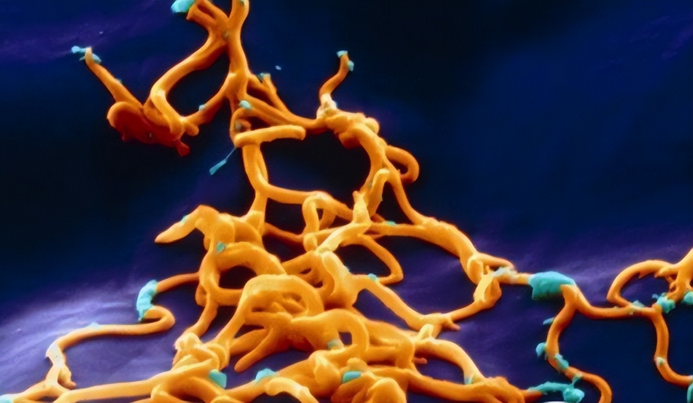 世界上最致命的病毒九种,细菌和病毒哪个更致命