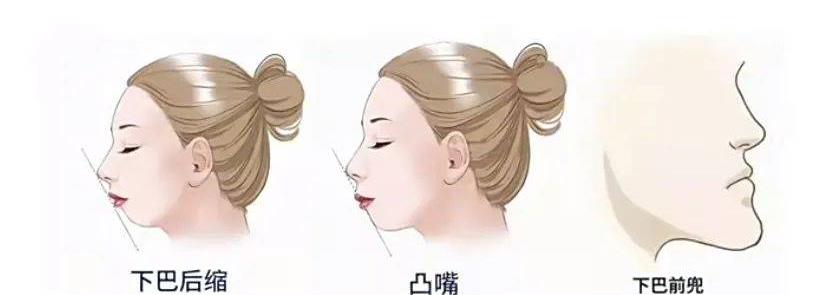 想把刘海剪了怎么办,刘海怎么剪整齐