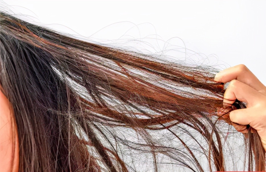 引起头发掉的原因有哪些,头发各种问题解决办法