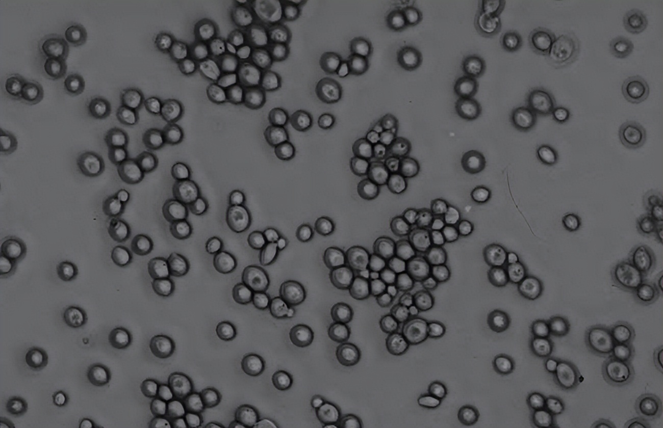 感染艾滋病毒后，你还能活多久？