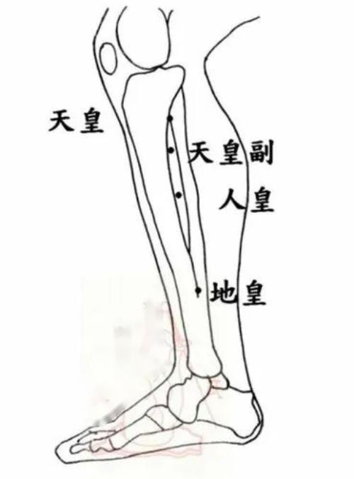 泌尿系疾病针灸,泌尿系统感染针灸哪里最有效