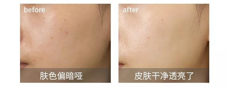 泥膜用多了屏障受损,护肤品推荐泥膜