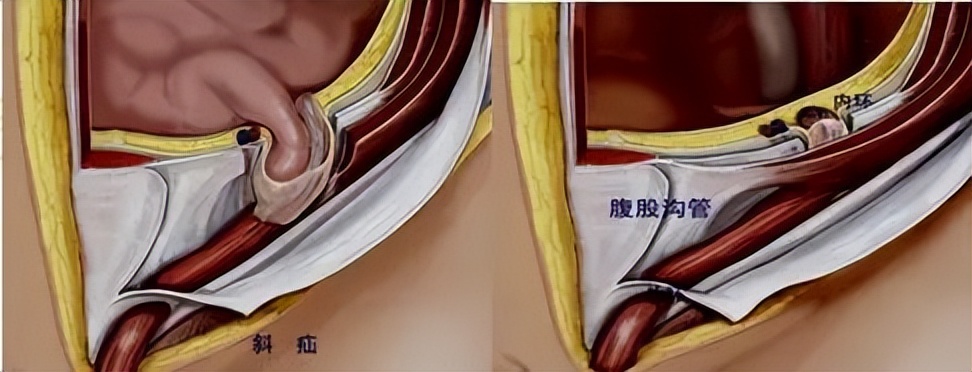 宝宝睾丸红肿应该去哪个科看,宝宝睾丸红肿医院消炎