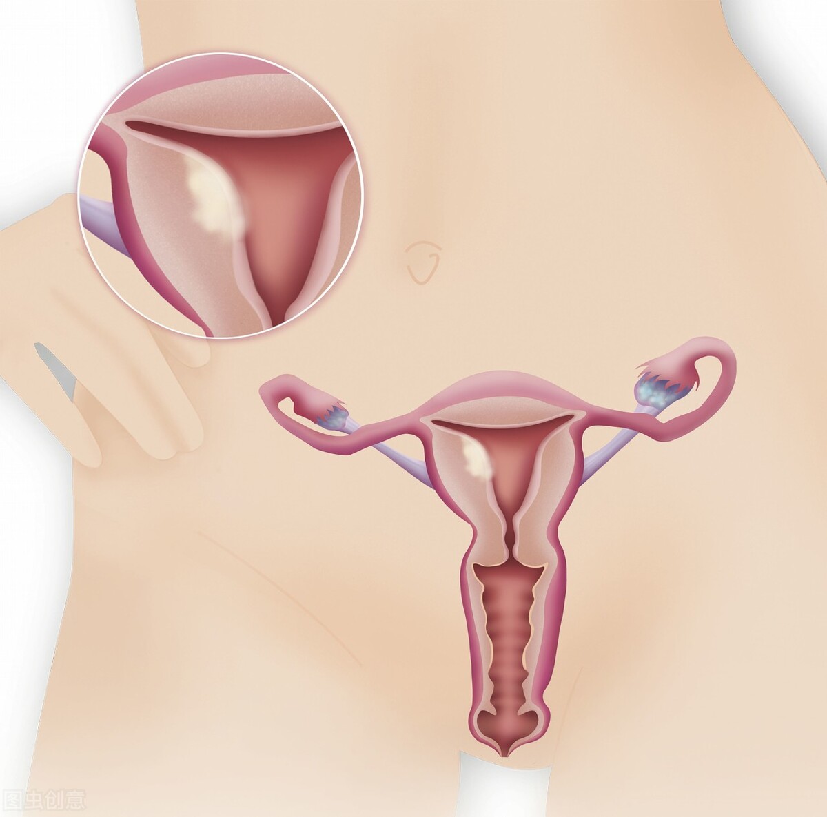 科普|妇科B超能查啥？异常情况会这样描述