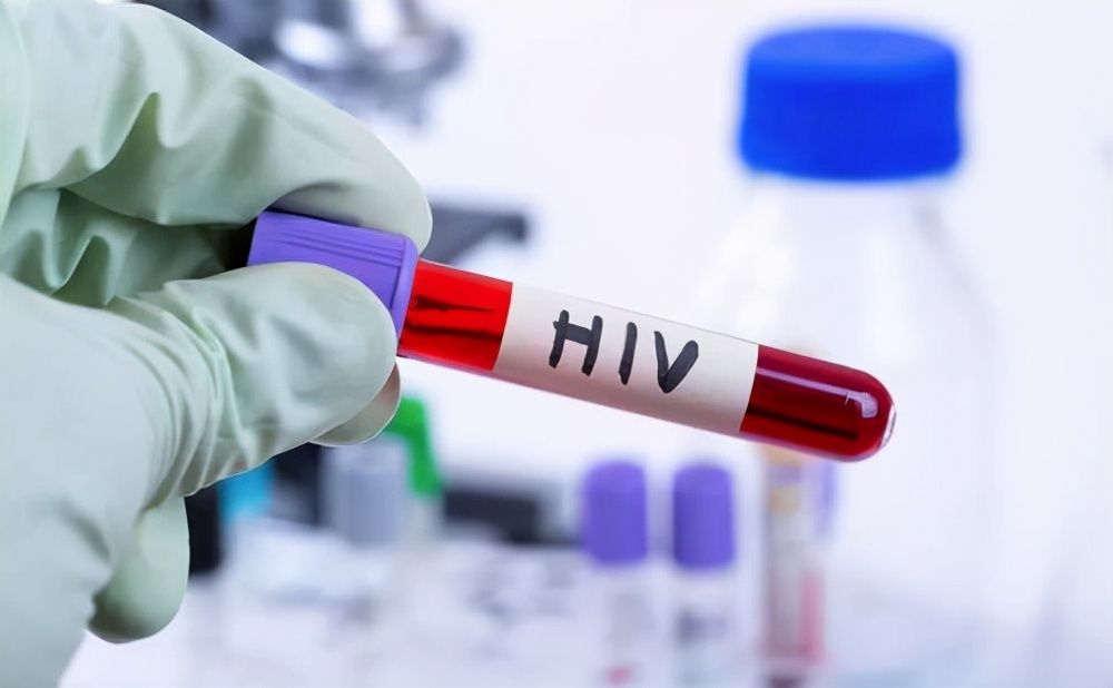 4大性传播疾病都有什么,哪些病可以通过性传播