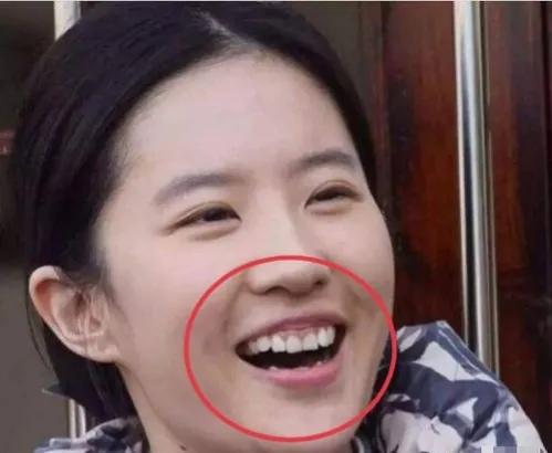 明明是绝顶大美女，却被牙齿拉胯，这15位女星苦不堪言