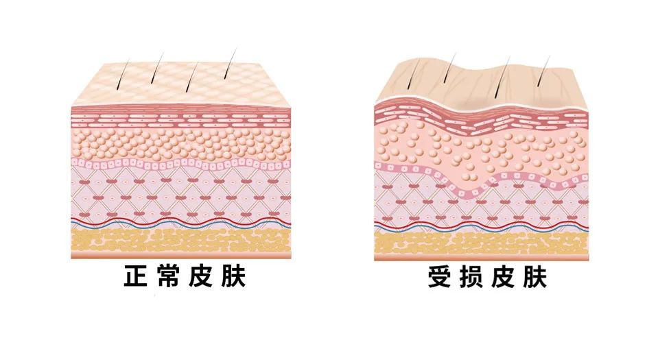 iii型胶原蛋白原料,胶原蛋白原料发展