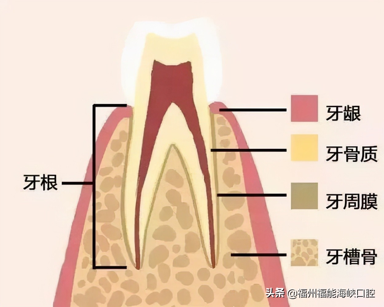 松动的智齿自己拔好还是医生拔好,松动的牙固定还是种牙好