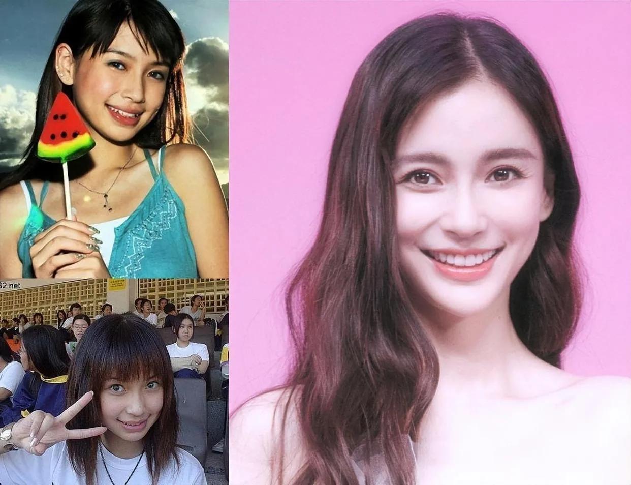 娱乐圈天然脸vs整容脸,娱乐圈没有整容的人纯天然的脸