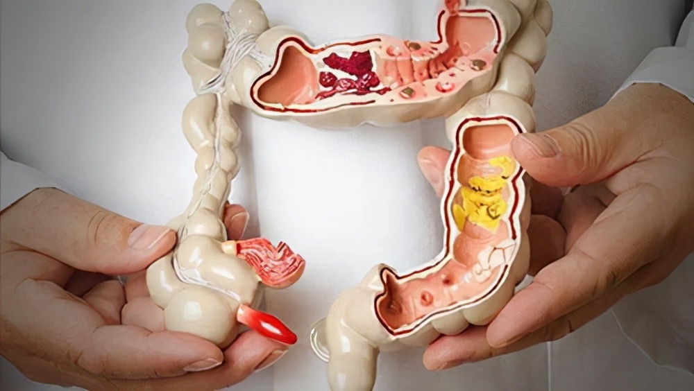 频繁放屁是怎么回事？医生：并非排毒那么简单，或是三种健康问题