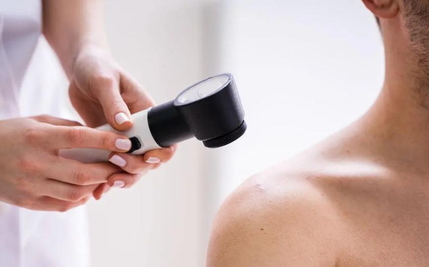 脖子和腋下的小肉粒如何治疗,脖子和腋下的小肉粒是什么丝状疣