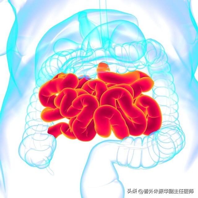 肠梗阻引起胀气怎么办,造瘘后发生肠梗阻怎么办