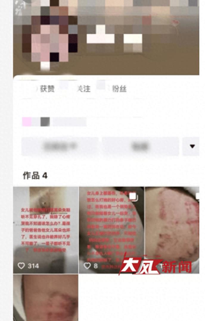 女子打妈妈致其耳膜穿孔警方通报,十九岁女孩被父母打