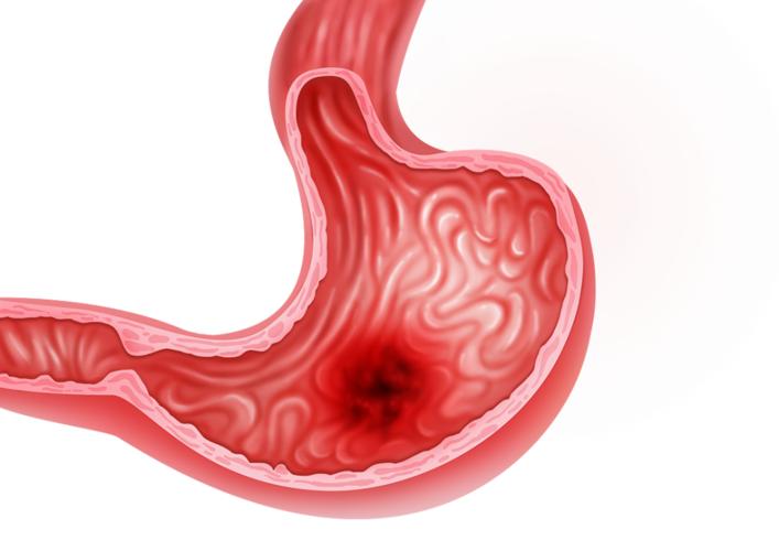 长期吃辣对身体有哪些好处和坏处,吃辣对身体有好处还是有坏处的