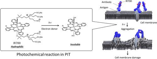 胆管癌光动力治疗,胆管癌做了ptcs还有治愈的可能吗