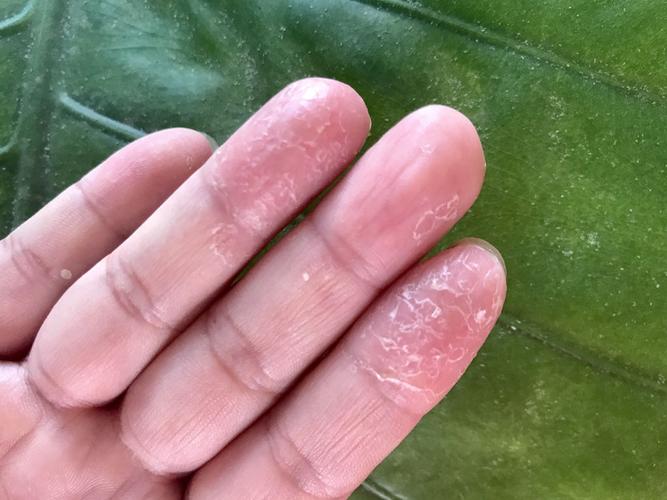 洗洁精的危害是谣言吗,洗洁精是害人精这种说法对吗