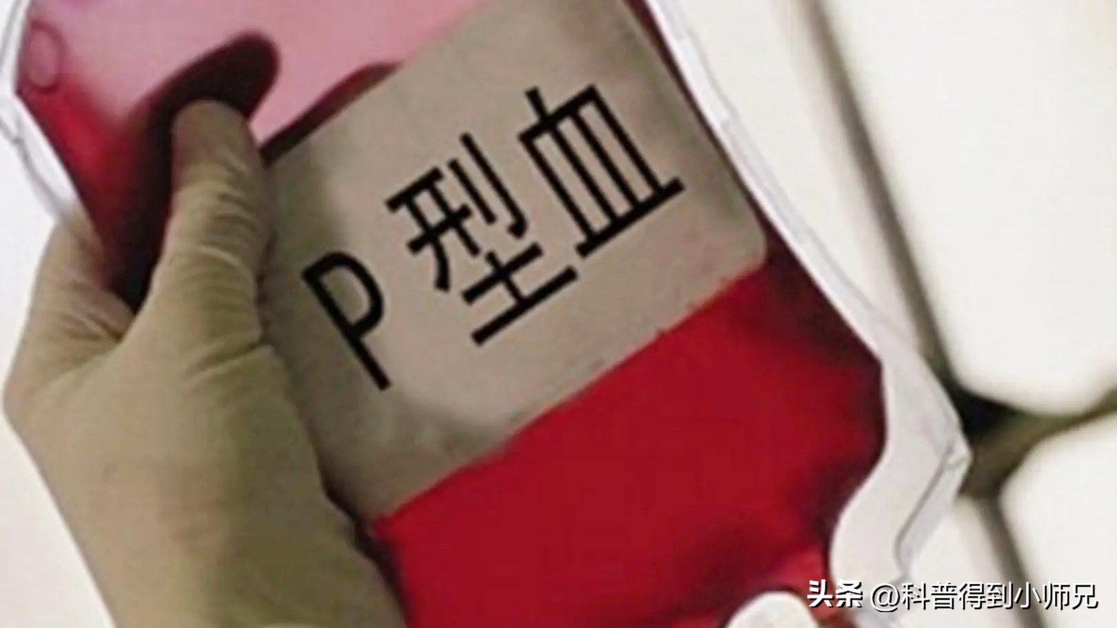 熊猫血恐龙血，人类有35种血型系统！除了ABO，你还知道哪一种？