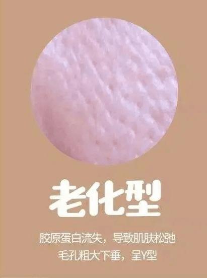 毛孔粗大黑头多脸爱出油怎么解决,解决男士毛孔粗大最简单方法