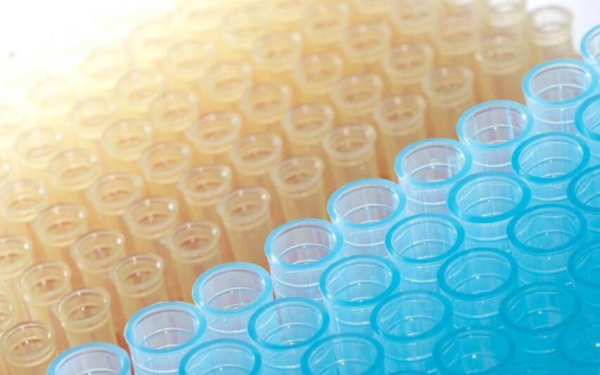 微塑料对血液有影响吗,科学家在人体血液中检测出微塑料