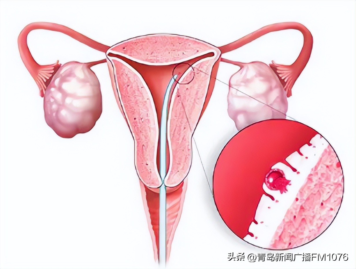 揭秘试管婴儿孕育全过程,试管婴儿诞生原理