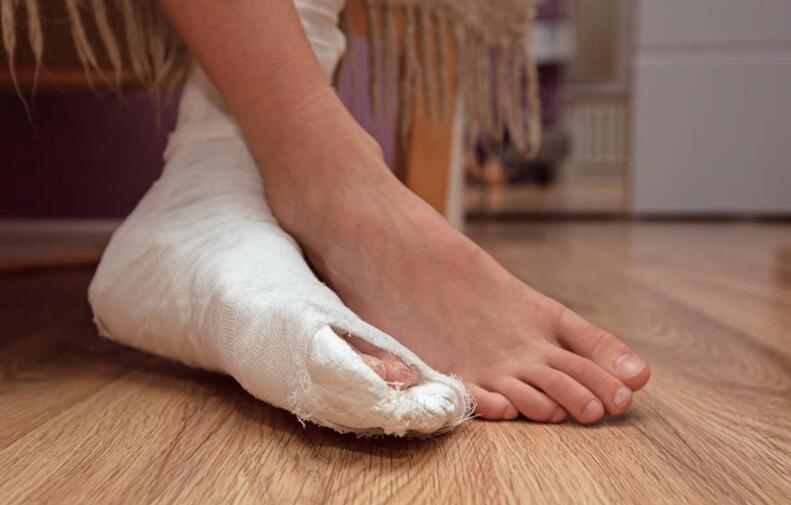 右手桡骨骨折手术后怎样不留疤痕,骨折术后拆线了会留疤吗