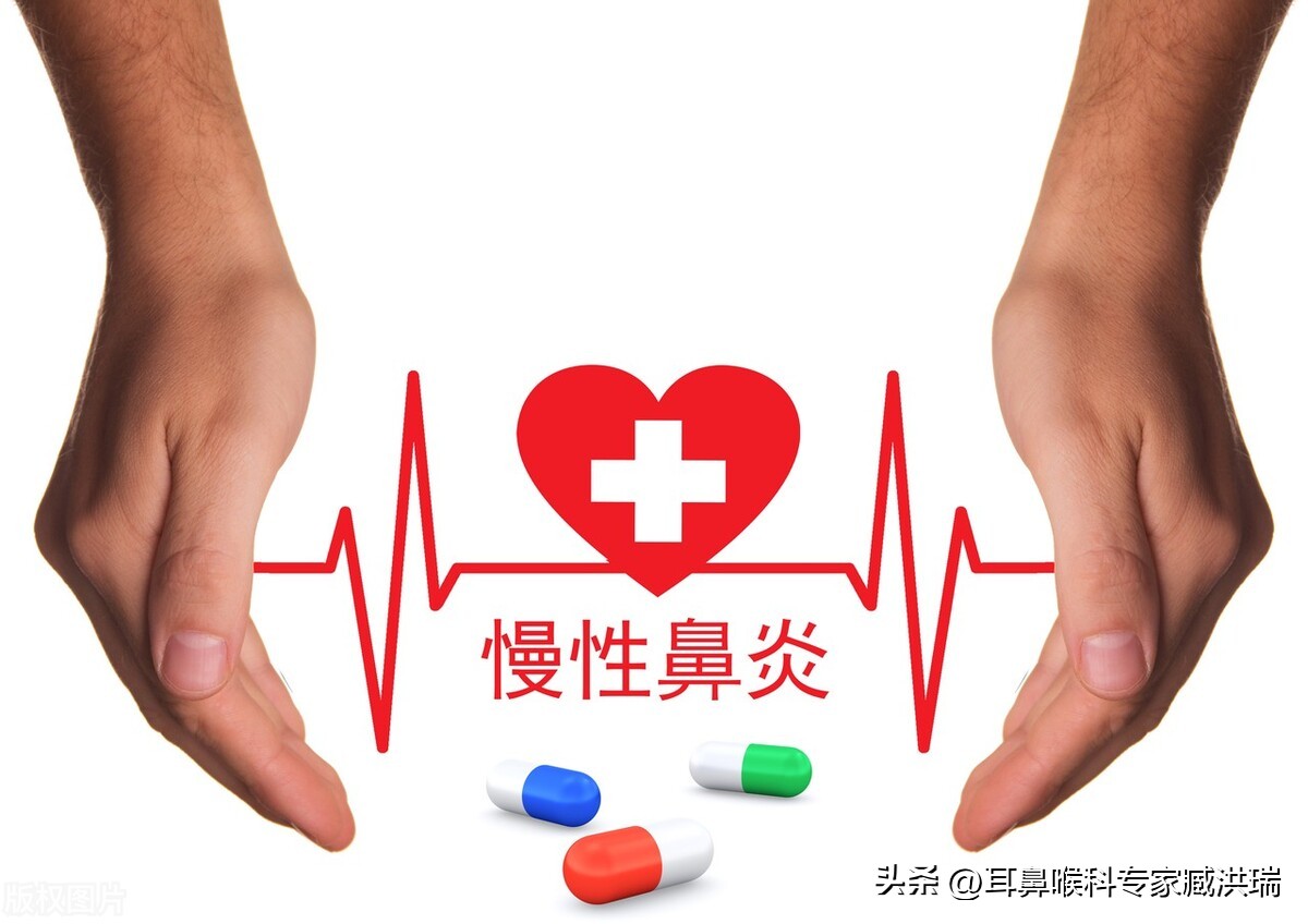 鼻息肉是一种常见的疾病，但如果不及时治疗，可能会引发并发症