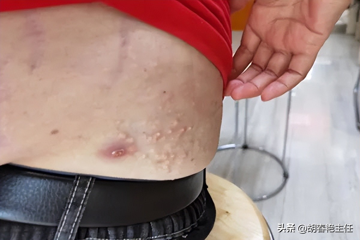 尿酸高的症状对身体有哪些危害,男人尿酸高的症状与危害