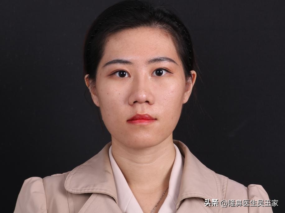 一个人，大老远的从外地跑到北京，只做“鼻翼缩小”，值不值？