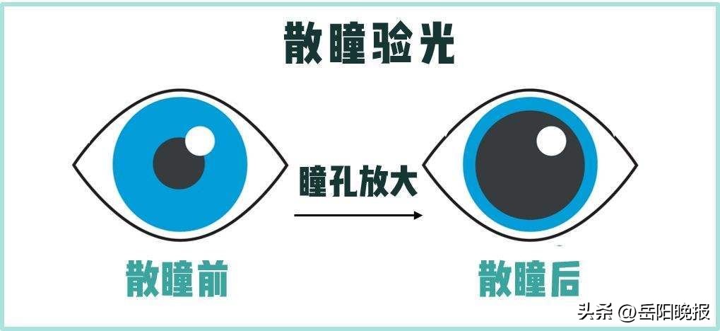 验光散瞳是什么意思,有必要做散瞳验光吗