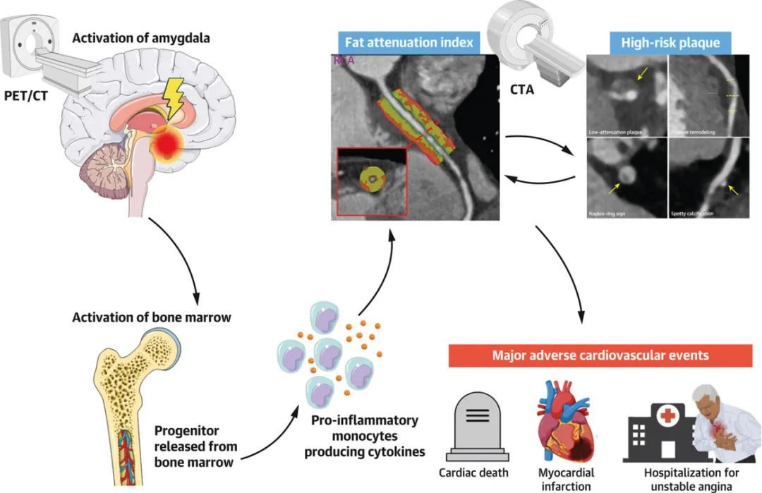 心梗生气容易猝死,年轻人突发心梗时更容易猝死