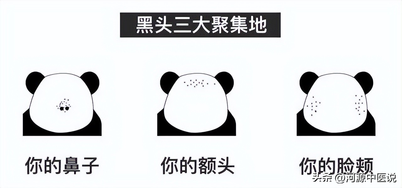 黑头应该怎么去99%的人不知道,黑头处理的最佳方法医生推荐