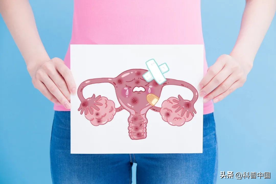 宫颈癌高发的罪魁祸首,13岁女孩患宫颈癌7年