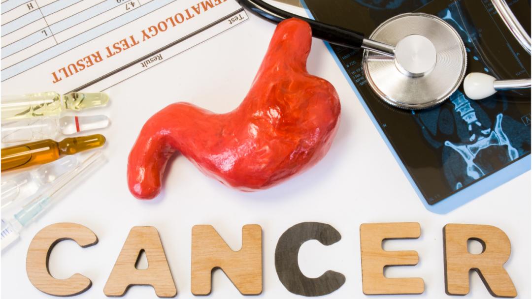 老人胃癌恶性最近老肚子难受,70岁老人胃癌晚期不治疗能活多久