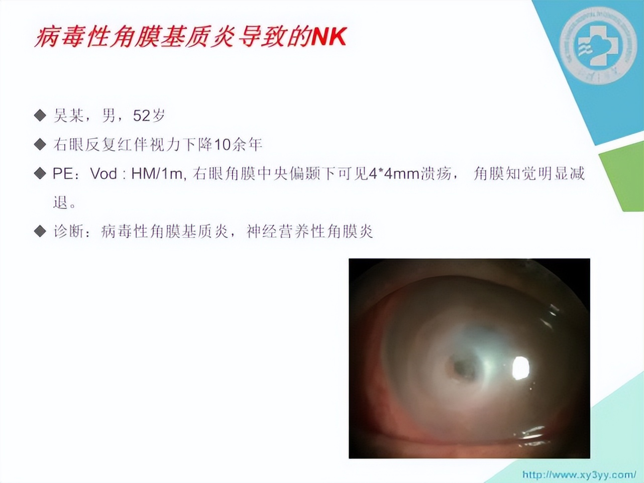 邓志宏几号坐诊,湘雅附三眼科邓志宏简历