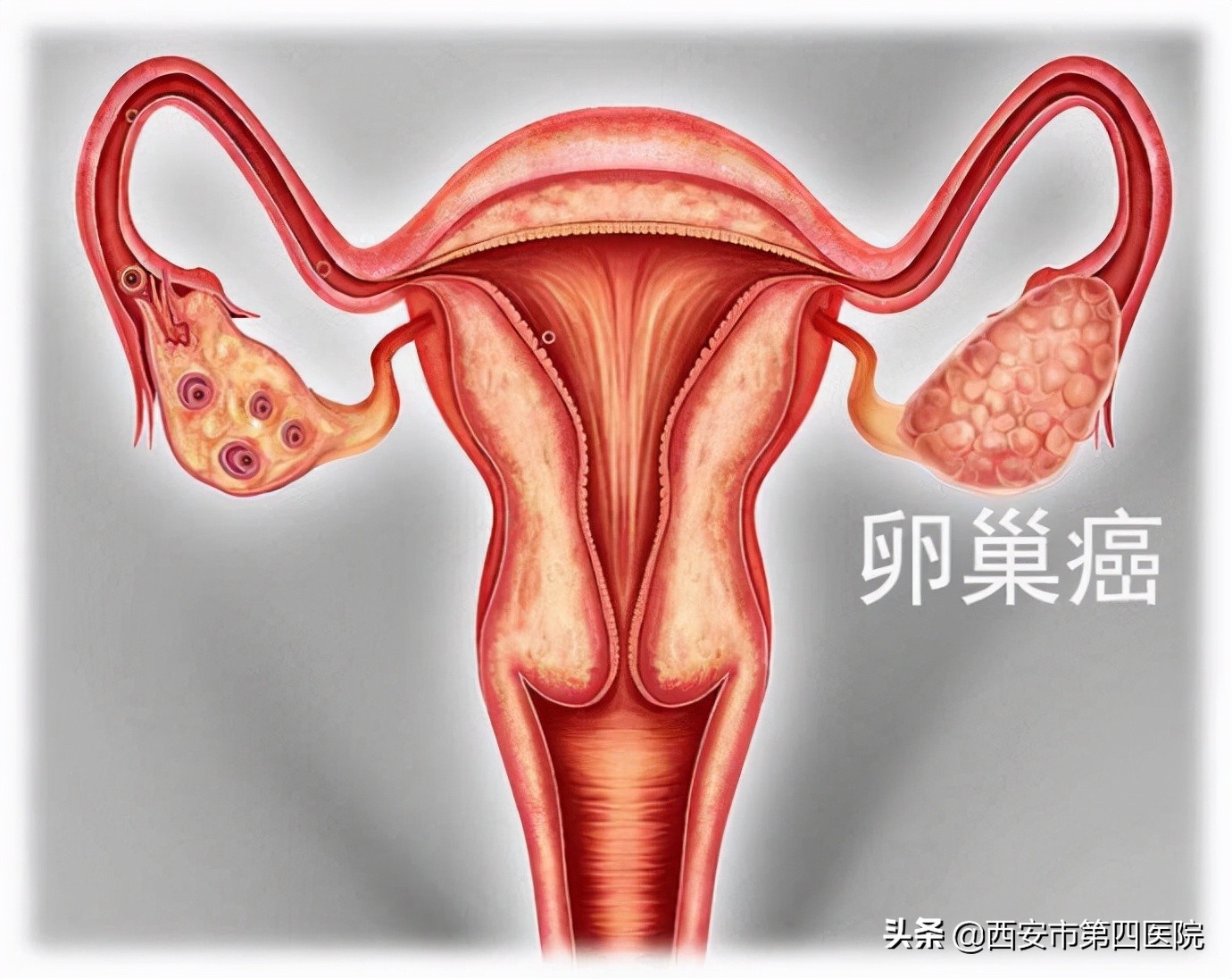 西安加油抗击疫情必胜,西安加油战疫情