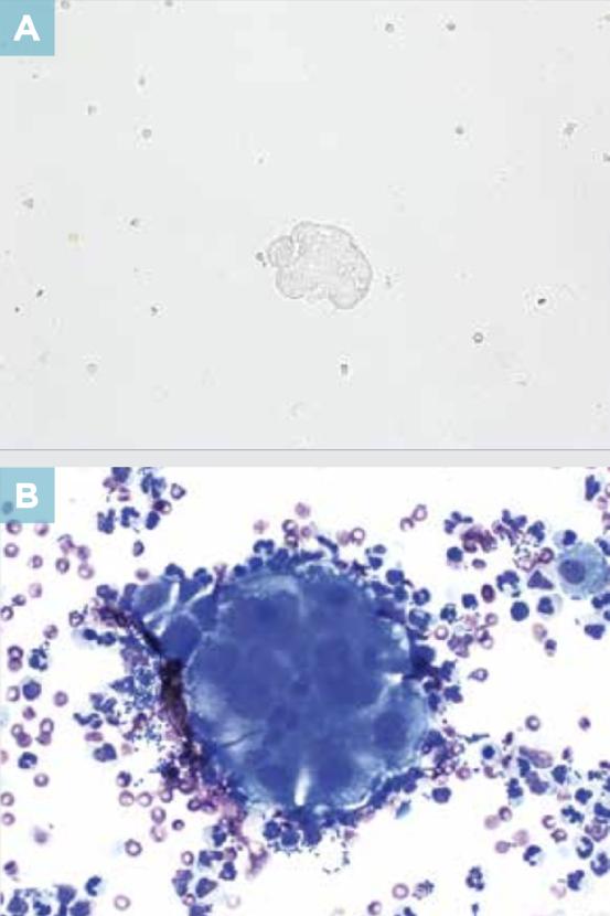 尿液干化学分析的实验原理,尿液标本采集操作