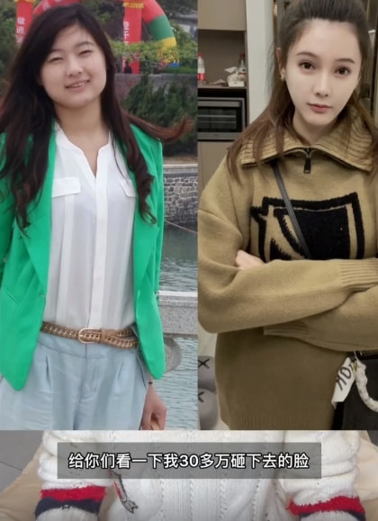 女网红整容变化,整容失败女网红对比