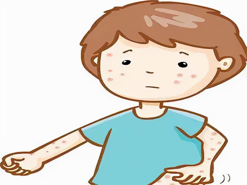 毛囊炎病因演示过程,毛囊炎的诊断与鉴别诊断