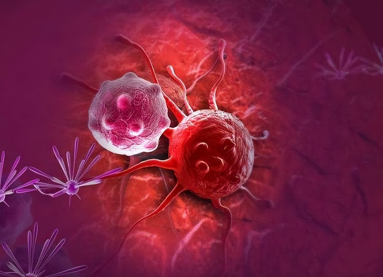 囊肿切除手术需要注意什么,囊肿手术切除需要注意什么