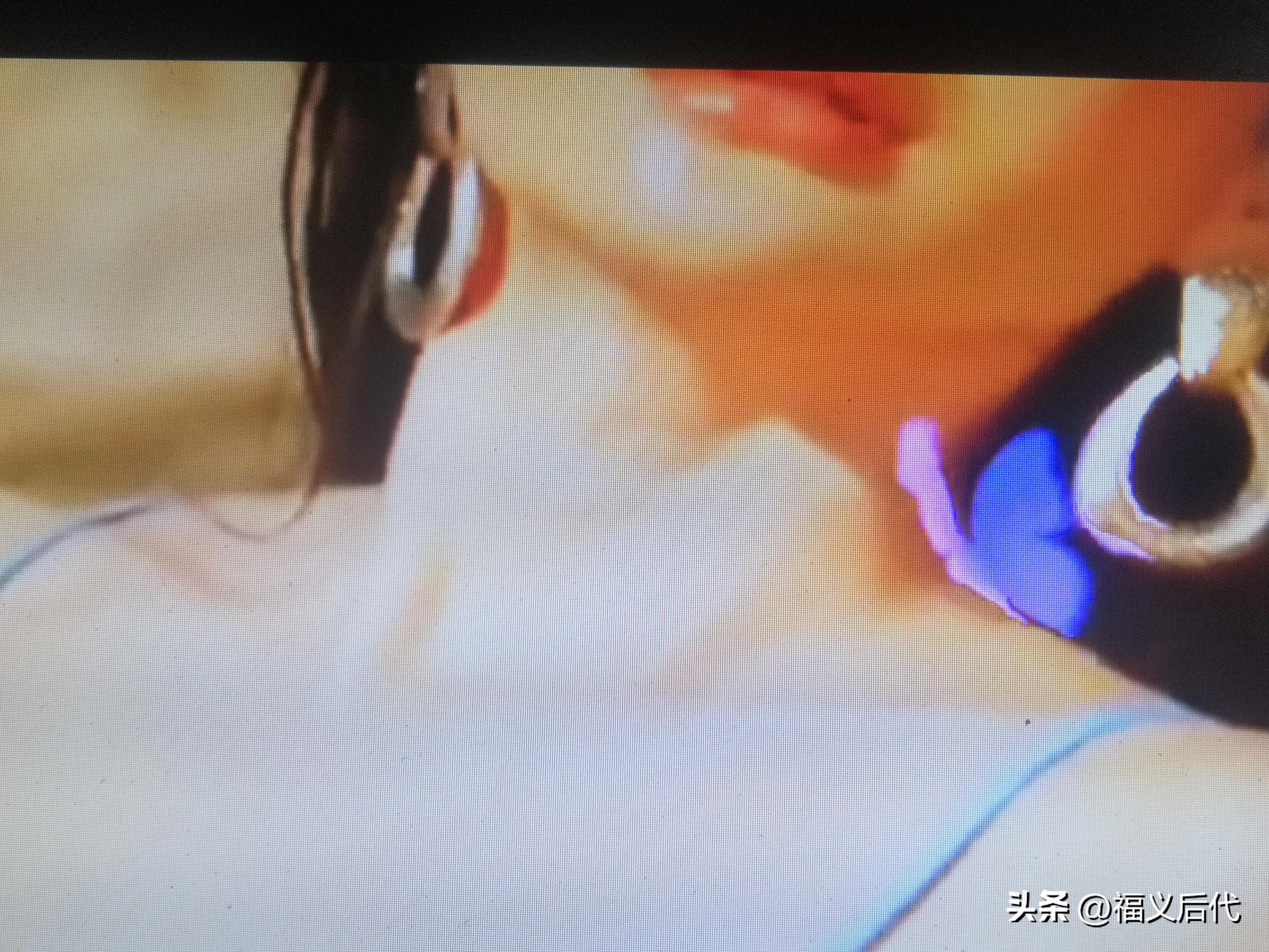 境外输入导致国内麻醉剂犯罪案件增加，打击*药迷**与听话水刻不容缓