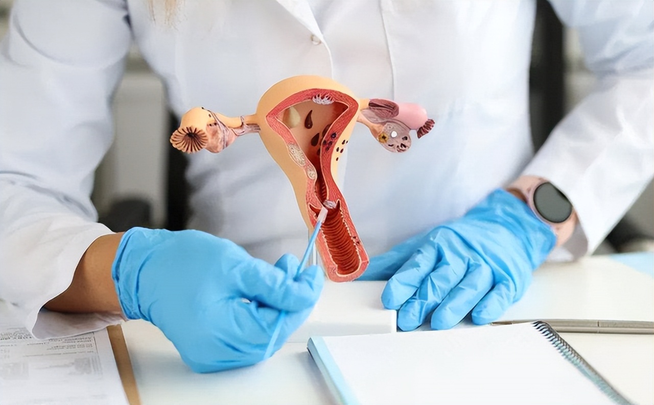 女人摘掉子宫后的下场,女人摘掉子宫有什么后遗症