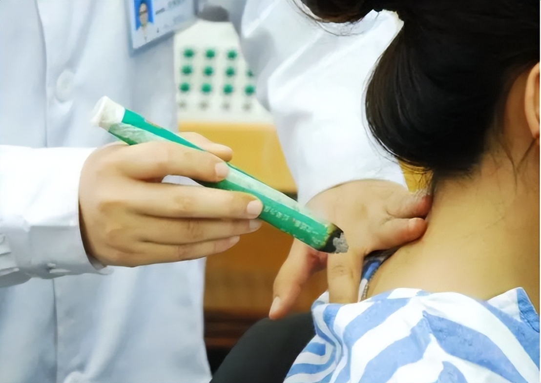 持续性头晕中医能治疗吗,头晕可以要中医调理吗