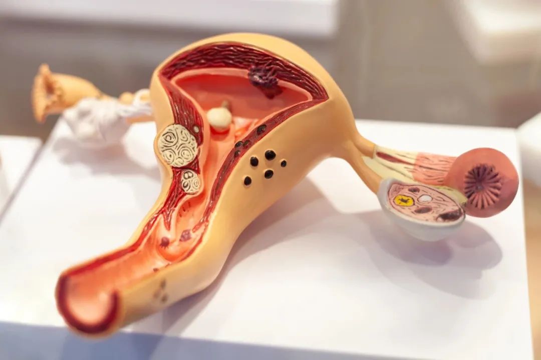 临床适应症｜干细胞对于薄型子宫内膜的修复作用及其临床意义