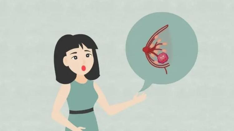 乳腺纤维瘤年轻女性发病率,19岁女孩乳腺纤维瘤多大切除好