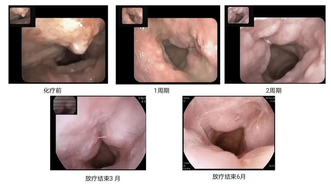 一觉醒来嗓子哑了不能说话,一觉醒来嗓子哑了也不疼