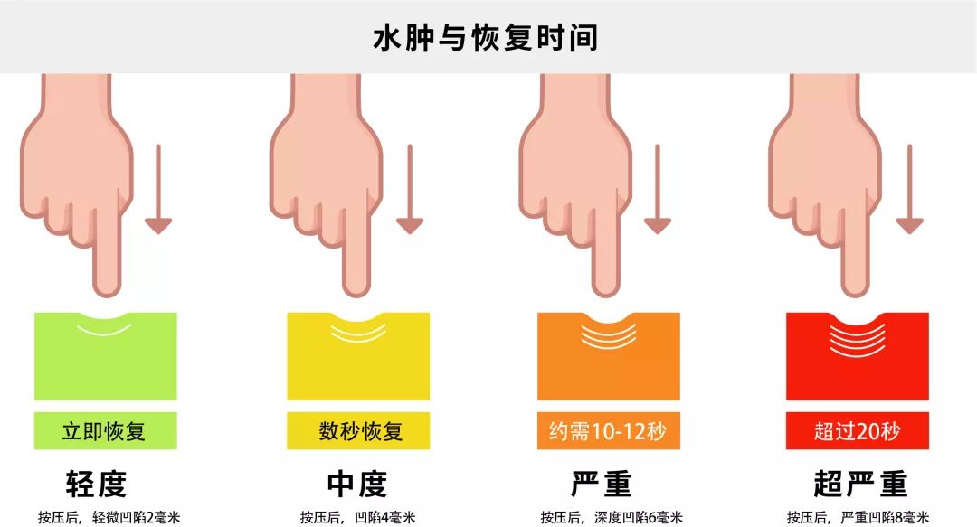 淋巴水肿外阴肿怎样锻炼,淋巴水肿引起腿肿怎么治