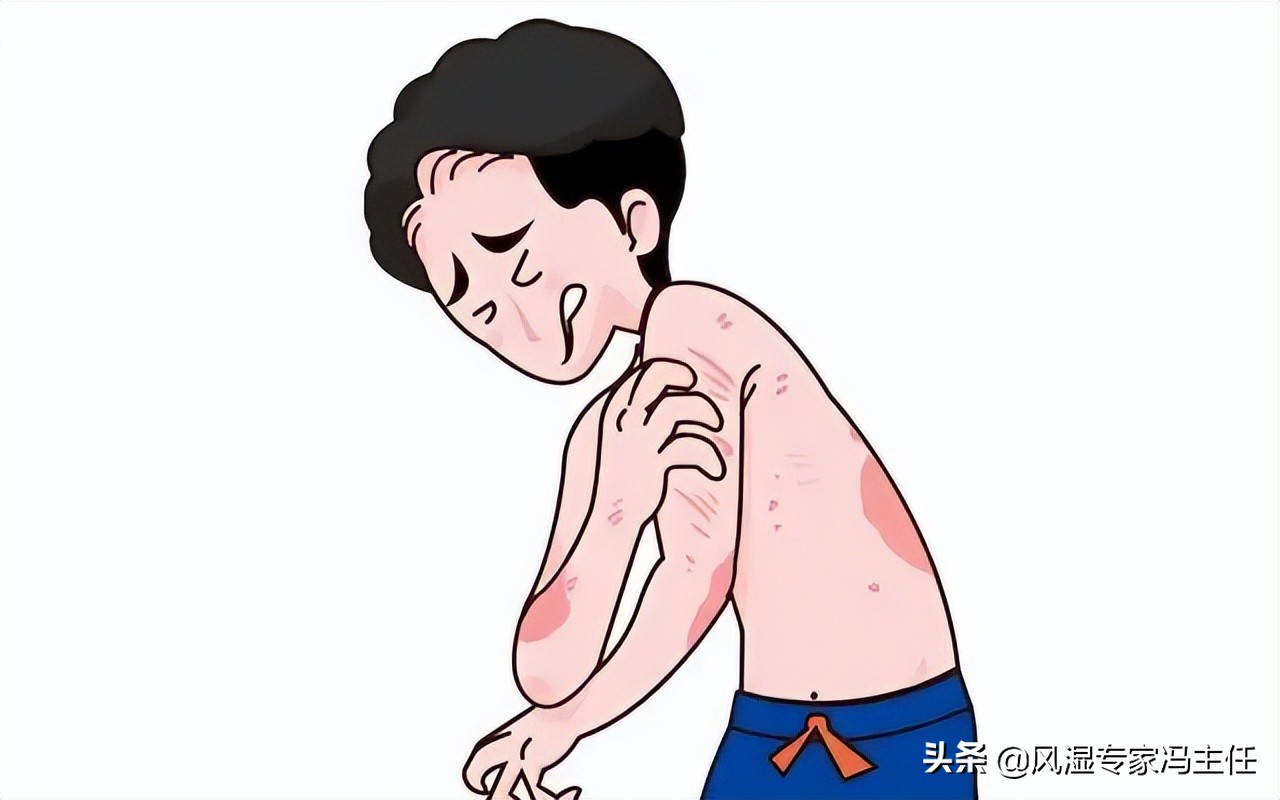 13岁少年患银屑病怎么办,银屑病老中医能根治吗