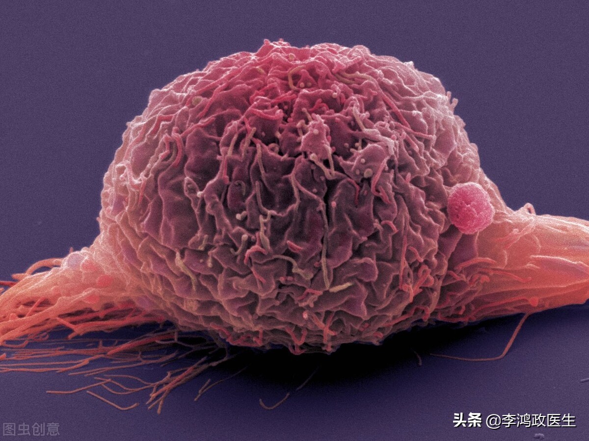 腰间盘突出有没有可能误诊,女子腰痛误诊腰椎间盘突出