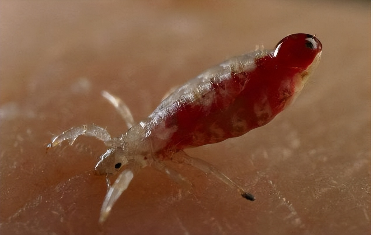 男子腹部痒,男性大量阴虱和虫卵